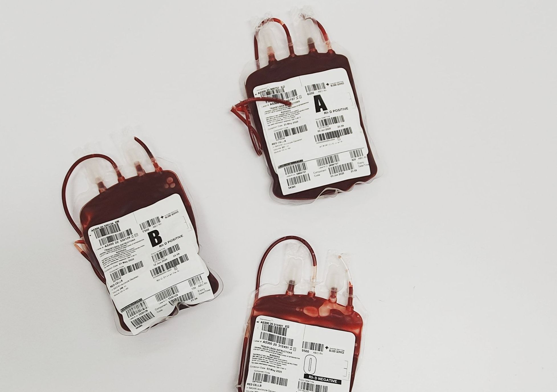 Three labeled donor blood bags showing A, B, and O blood type units with Rh D positive and negative markings